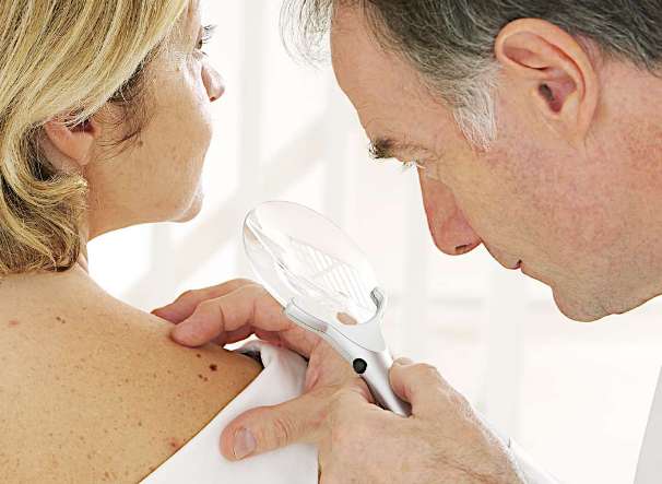 Indicazioni su quali siano i rimedi - con relativi costi - per rimuovere un angioma cutaneo.
