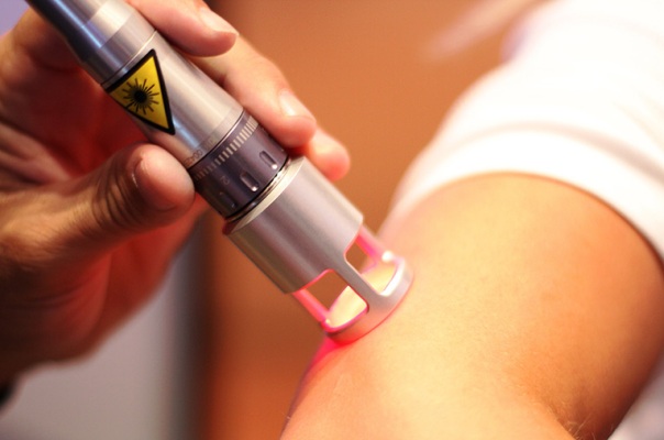 I costi della laserterapia dipendono dal tipo di trattamento che si deve effettuare.