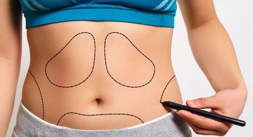 I prezzi per una liposuzione a Brescia variano in funzione della fama del chirurgo e delle dimensioni della area da trattare.