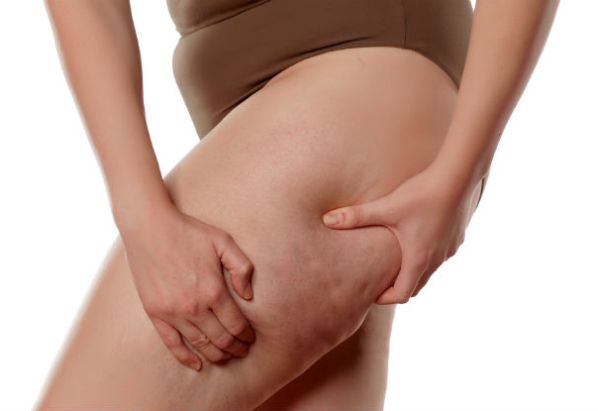 eliminare la cellulite definitivamente chirurgicamente