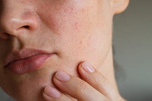 I prezzi per un intervento di ricostruzione cutanea dipendono dalle dimensioni della superficie da trattare.